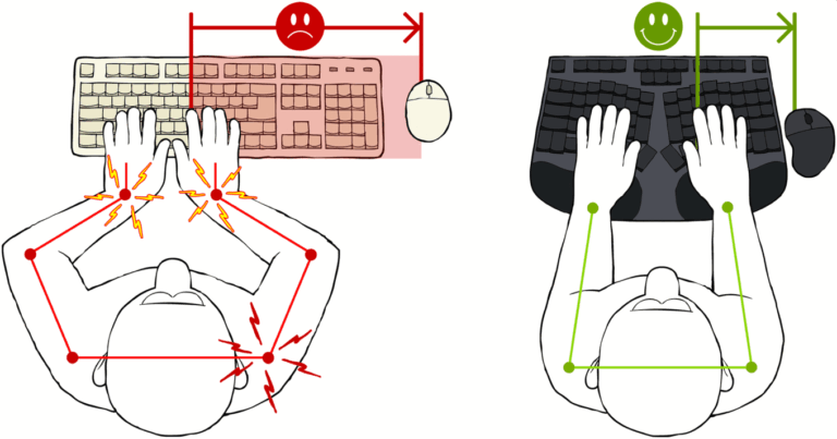The Best and Most Comfortable Ergonomic Mechanical Keyboard Truly Ergonomic Cleave - Reduce Conventional Typing Pain in Wrists and Shoulder